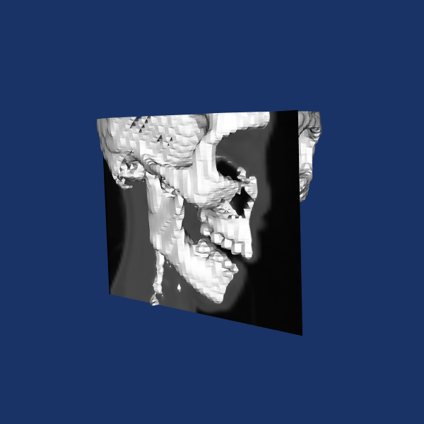 _images/Segmentation_Figure_2.png