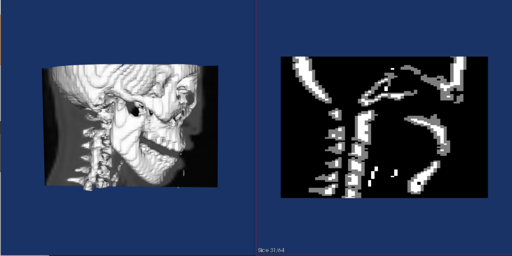 _images/Segmentation_Figure_3.png
